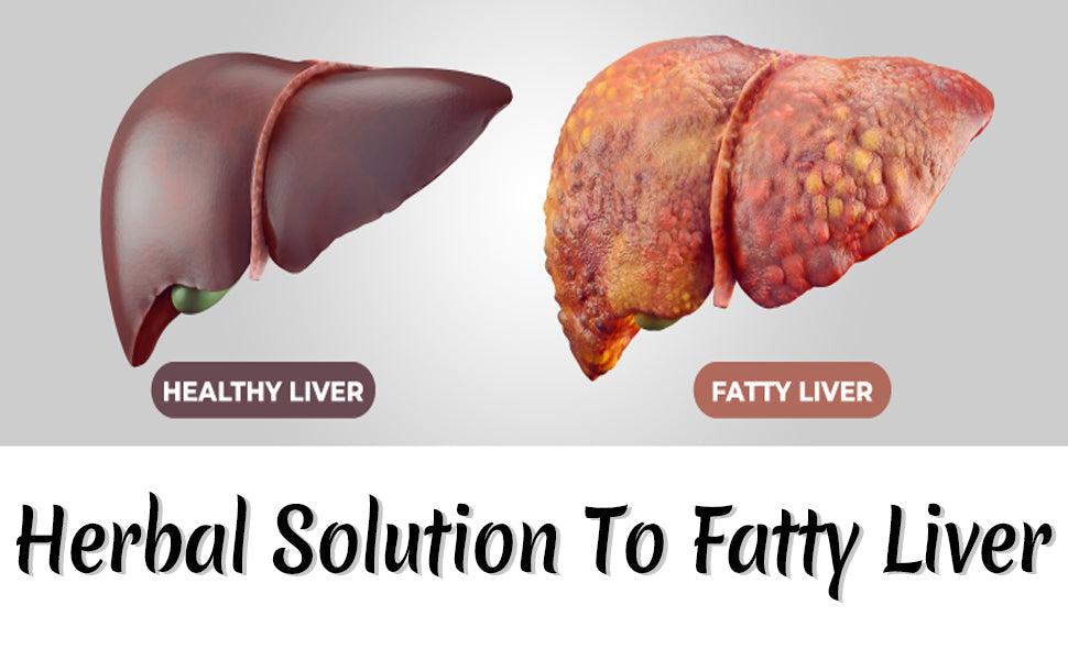 Fatty-Liver Healer Kit
