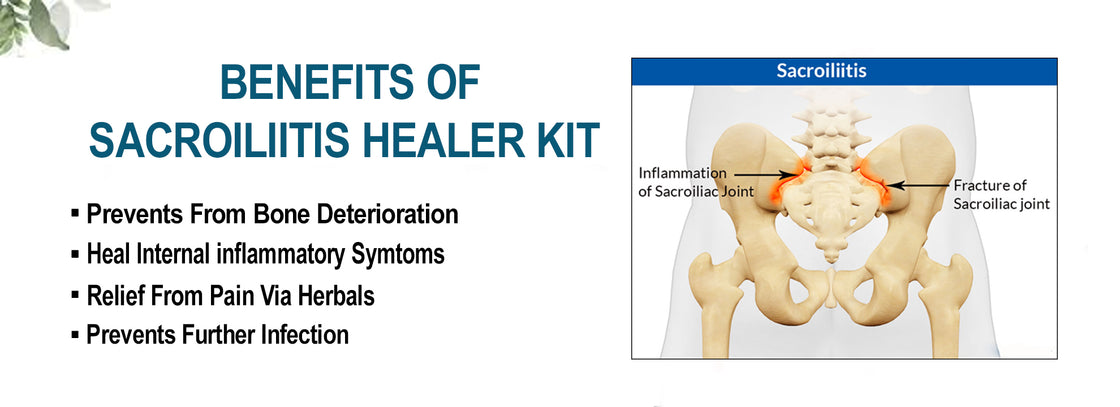 Sacroiliitis Healer Kit