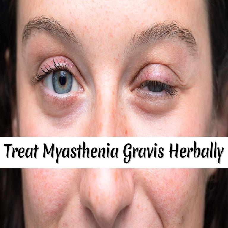 Myasthenia Gravis Healer Kit