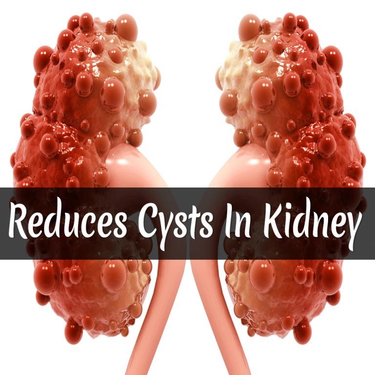 Polycystic Kidney Kit