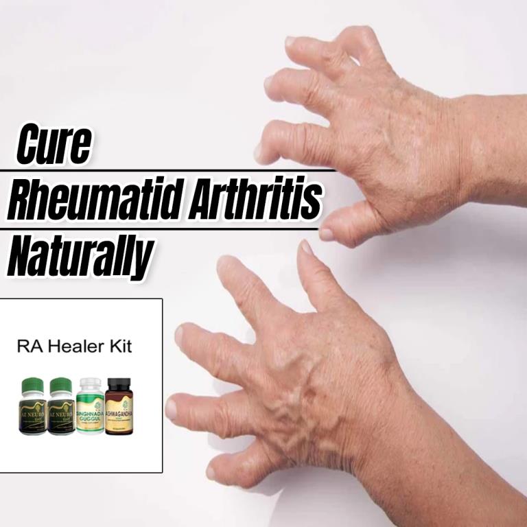 Rheumatoid Ayurvedic Treatment – Ayurveda Overseas Org